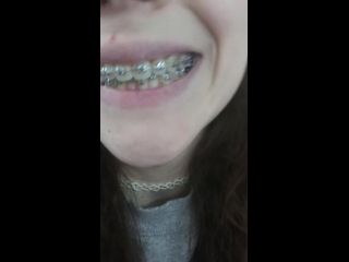 adult video clip 23 Braces tour | mouth fetish | fetish porn male feet fetish-8