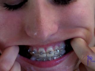 free online video 43 amateur homemade porn videos Cum On The Babysitter s Braces - [PornHub] (FullHD 1080p), fetish on amateur porn-9