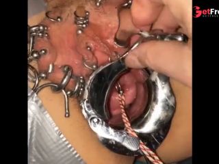 [GetFreeDays.com] Extreme cervix sounding Porn Leak December 2022-1