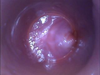 RAW endoscopic video-1