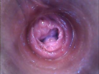 RAW endoscopic video-2