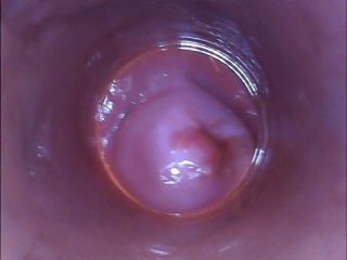 RAW endoscopic video-5