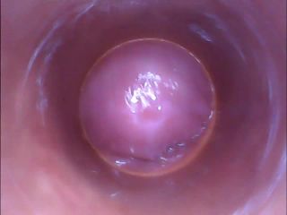 RAW endoscopic video-8